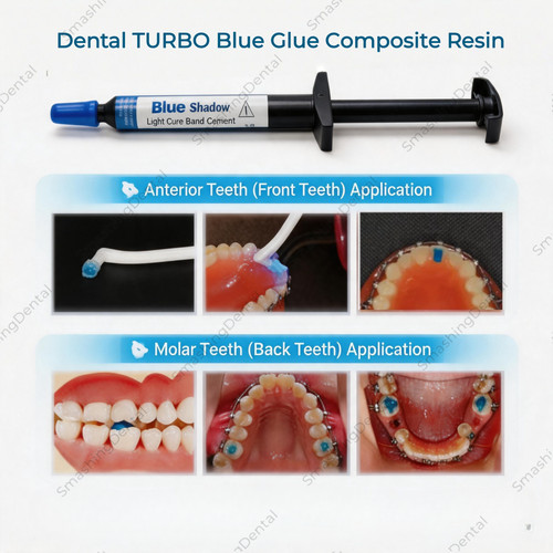 Dental turbo blue glue - turbo,
